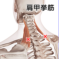肩甲挙筋のトリガーポイント